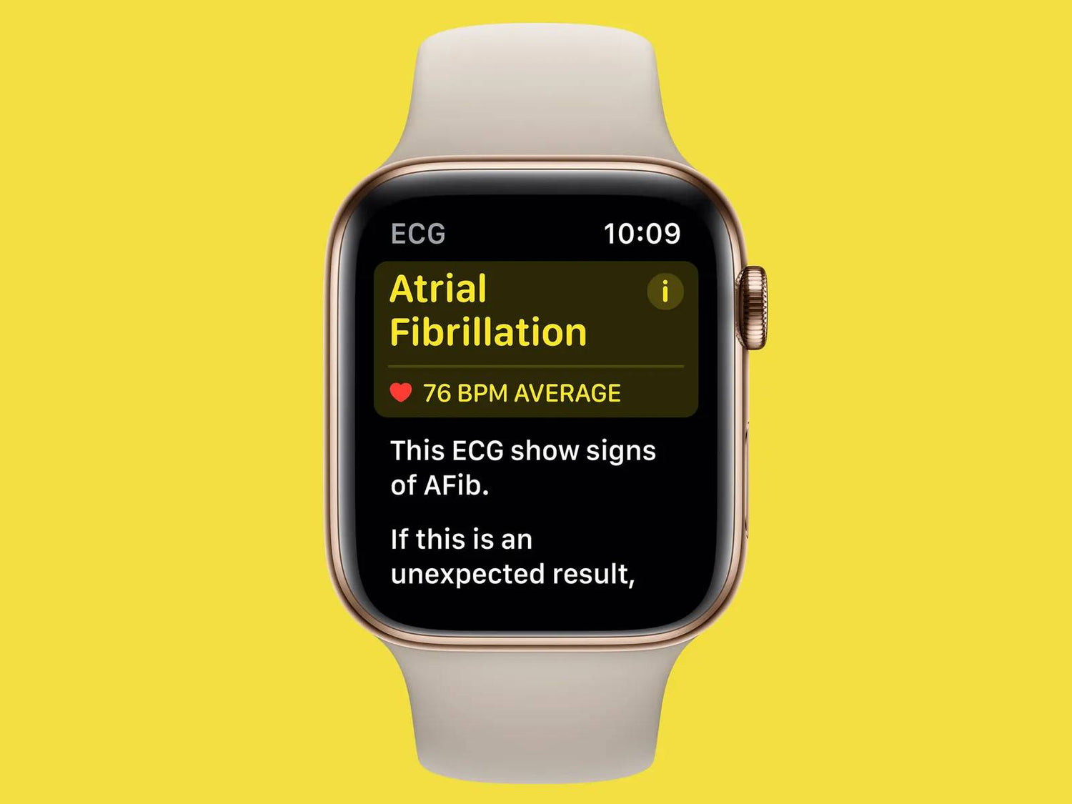 Smartwatches